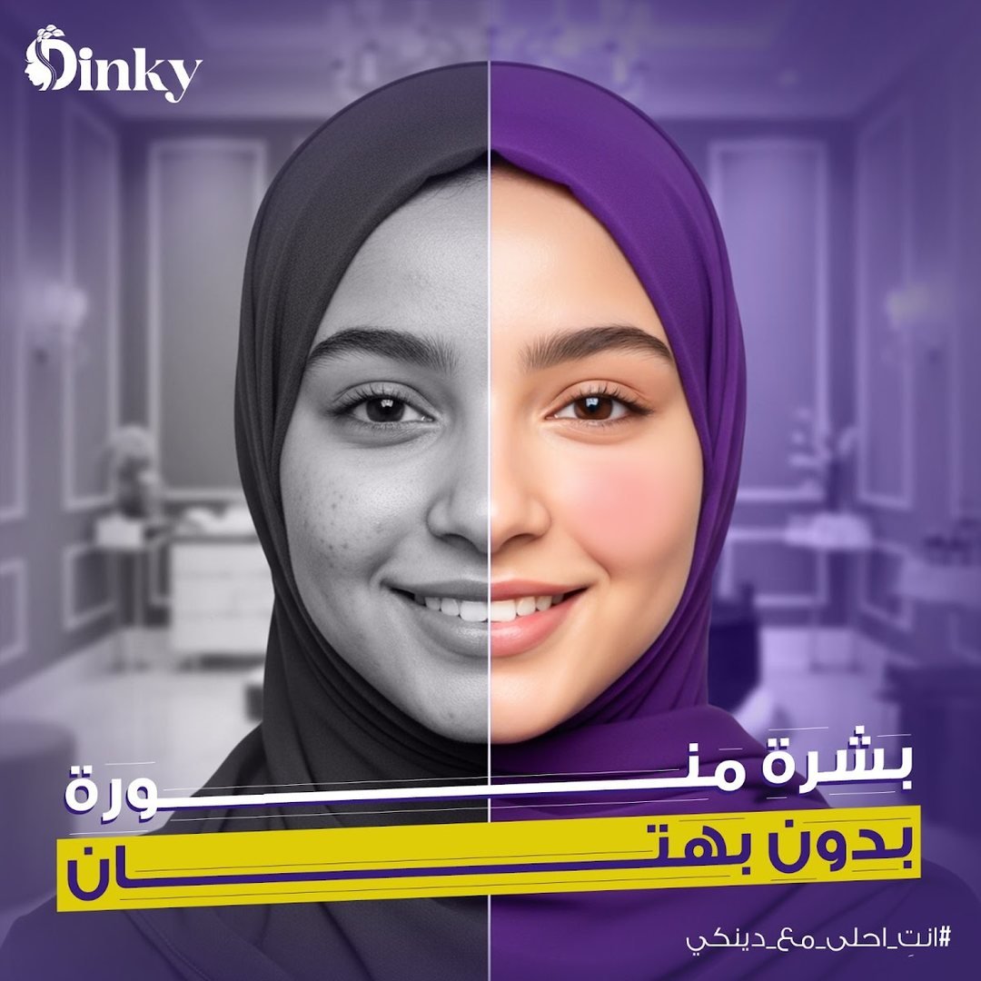 تصميم Dinky 13