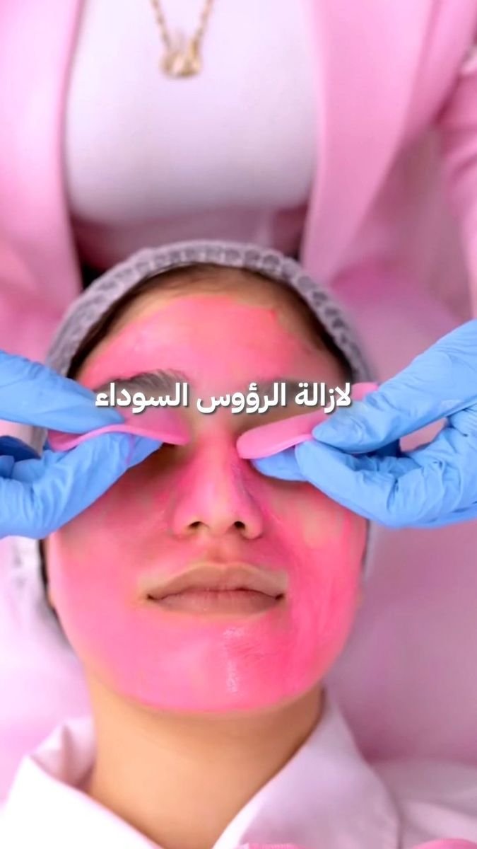فيديو Dinky 40